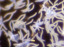 Desulfovibrio Gigas